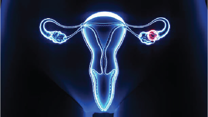 CSPC reported Phase 1 data for its nectin-4 ADC in advanced cervical cancer